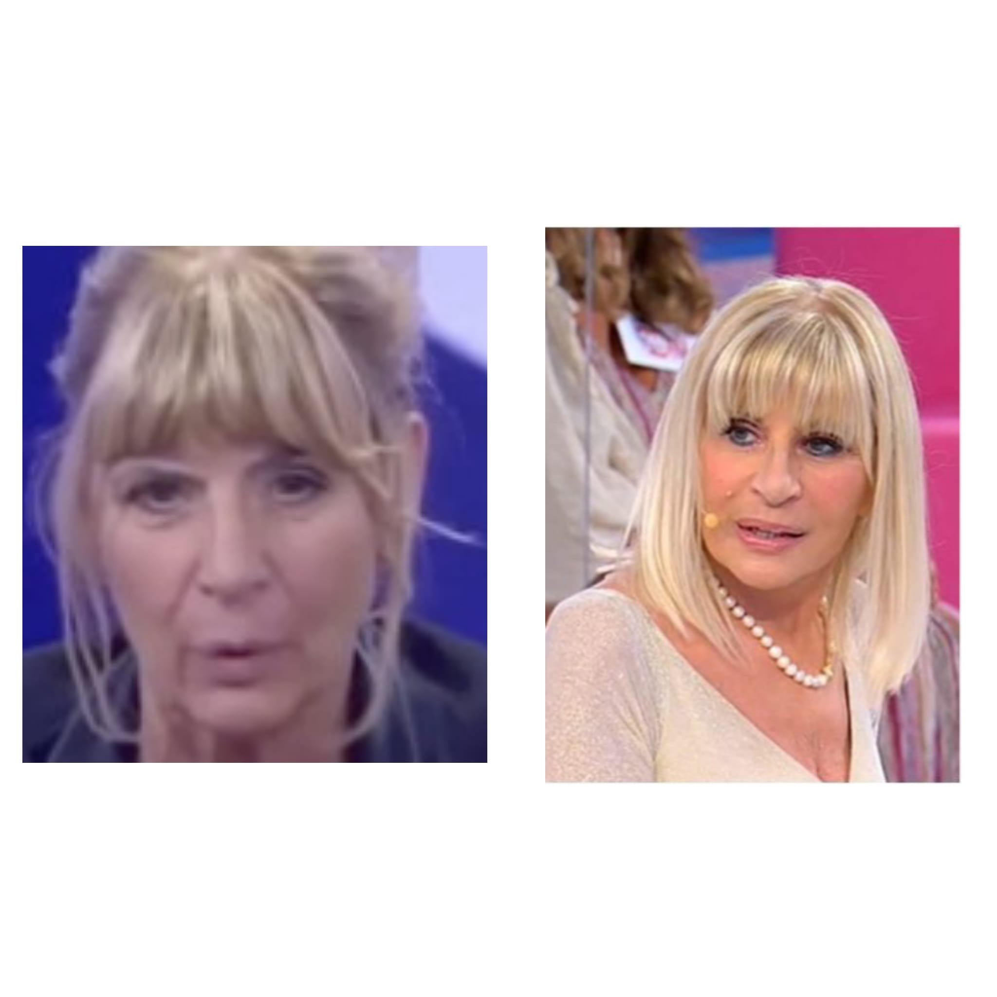 Transgender Uomini E Donne Prima E Dopo